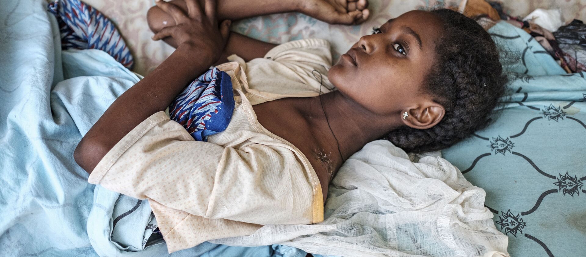 Девушка, пострадавшая в ходе боевых действий в Хумере, Эфиопия - Sputnik Mundo, 1920, 25.11.2020
