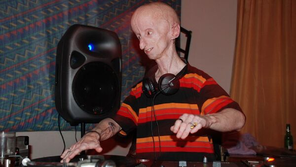 Una persona con progeria - Sputnik Mundo