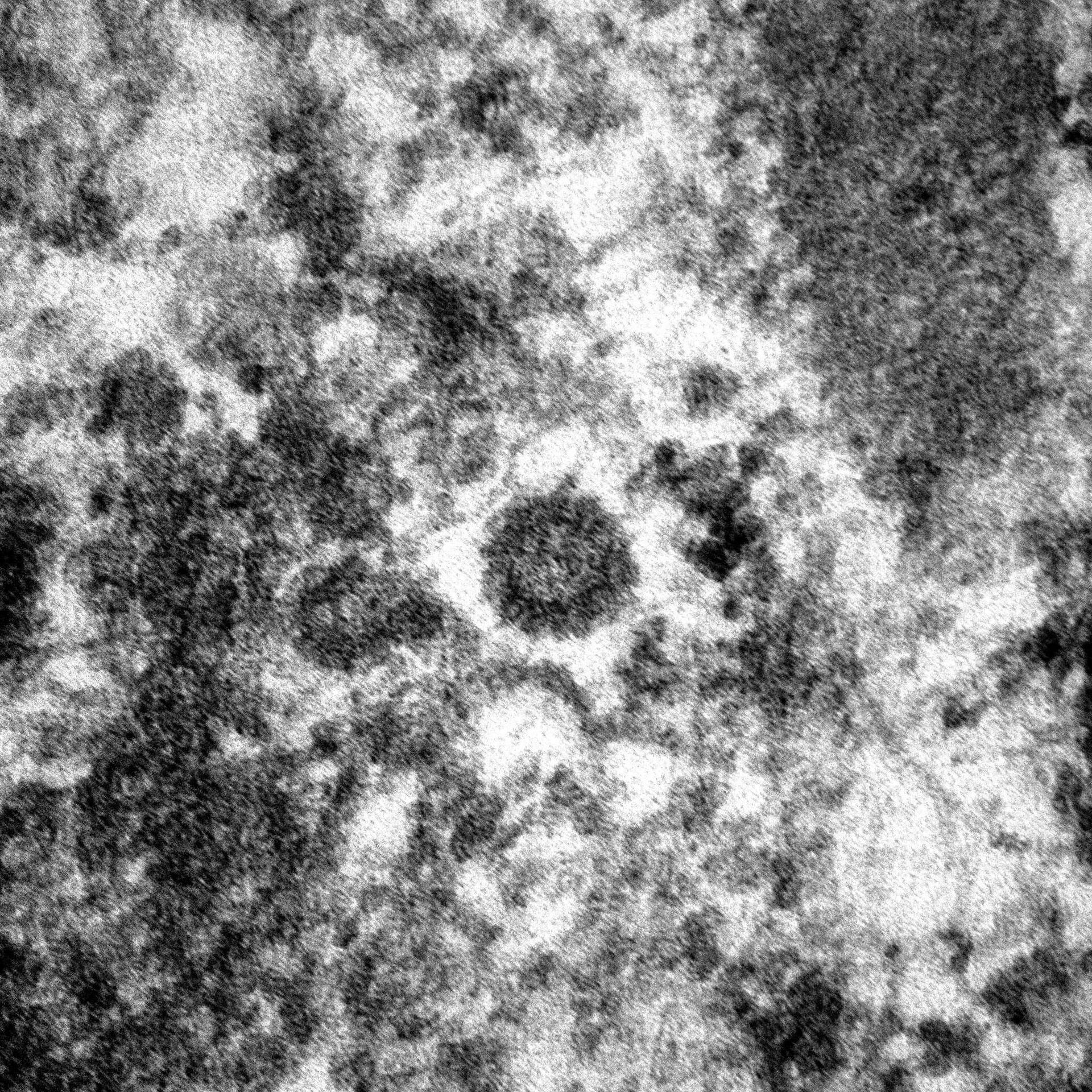 Así es el coronavirus ampliado dentro del organismo - Sputnik Mundo, 1920, 29.04.2021