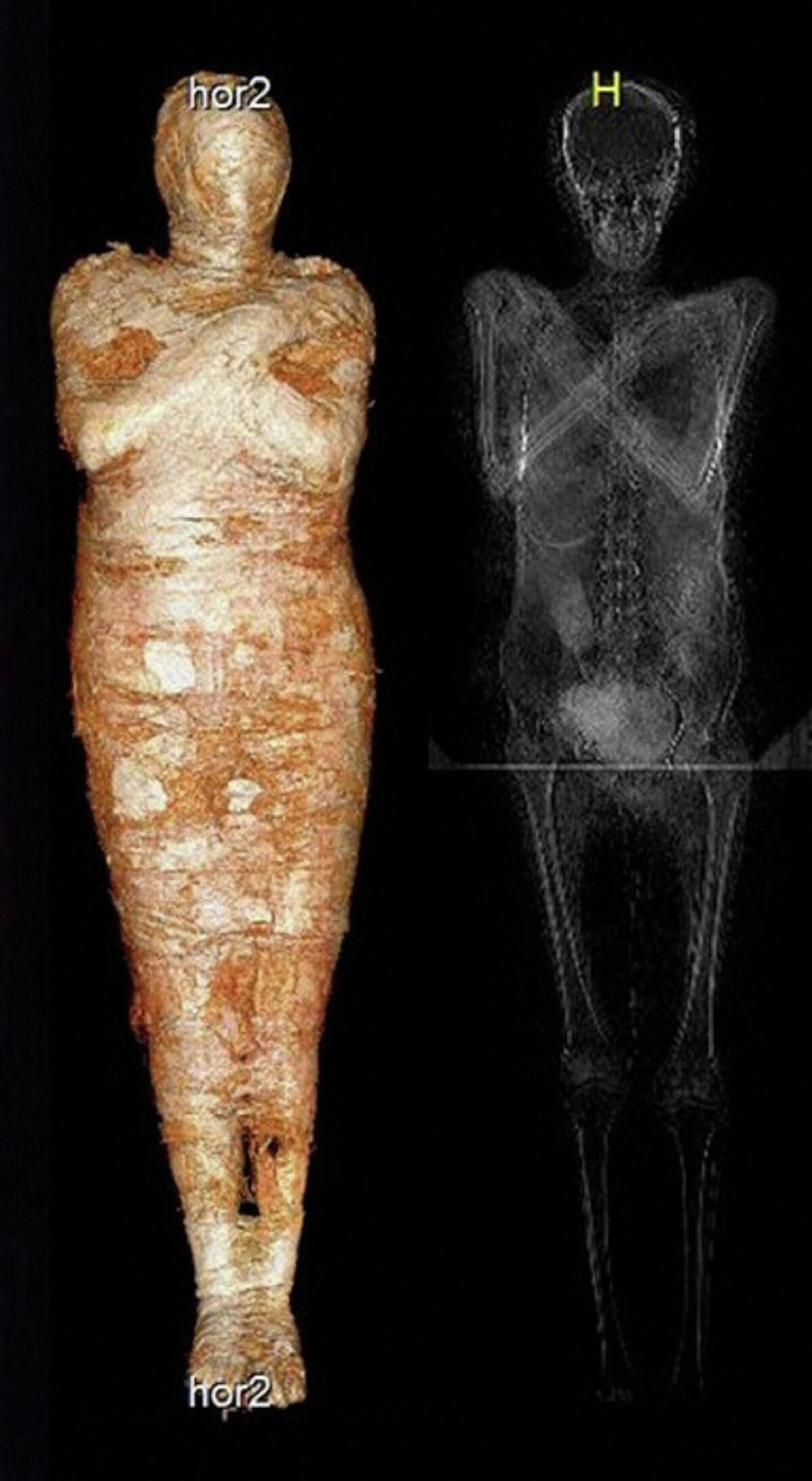 Las imágenes de rayos X de la primera momia egipcia de una mujer embarazada que se conoce hasta ahora - Sputnik Mundo, 1920, 30.04.2021