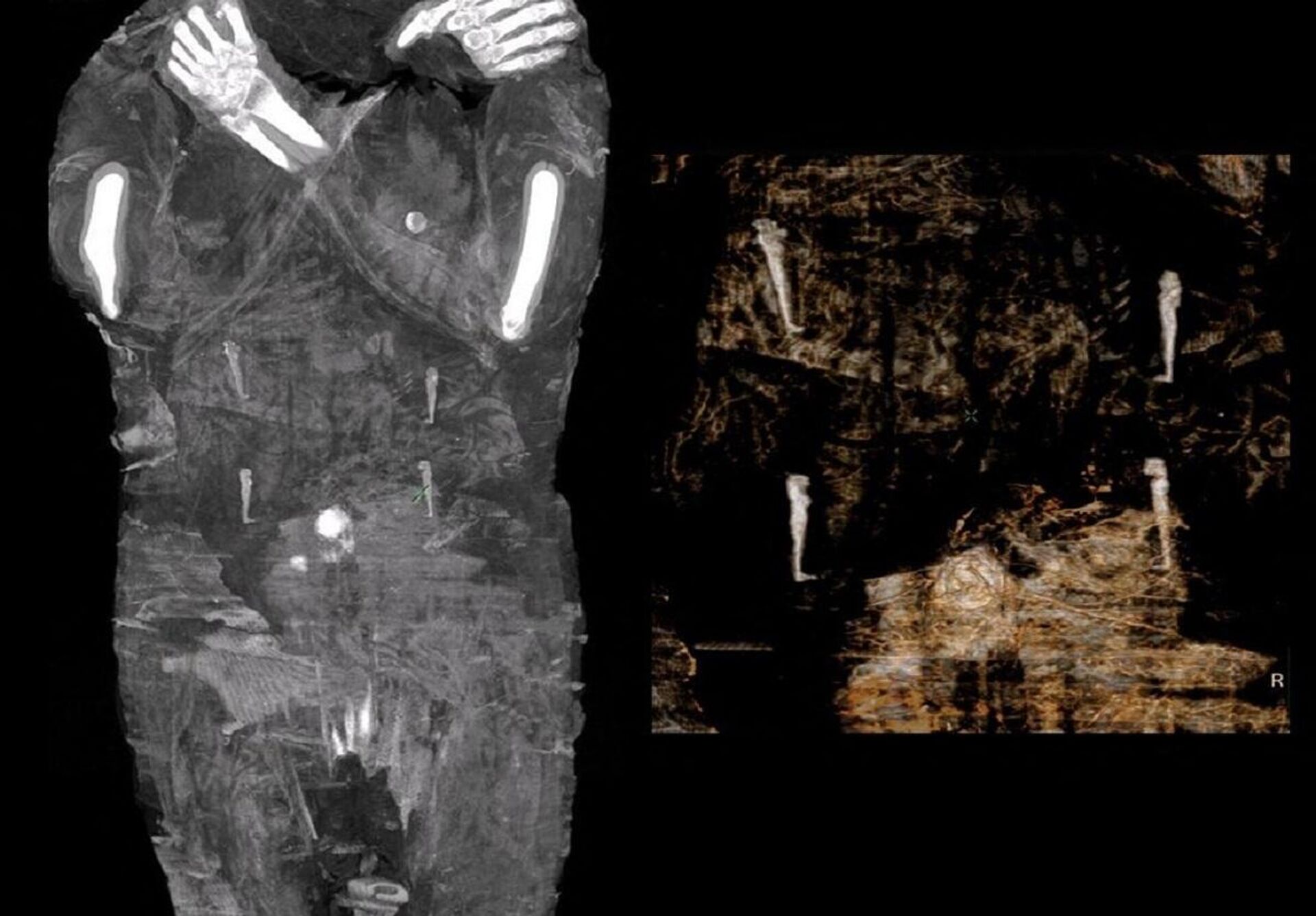 Las imágenes de rayos X de la primera momia egipcia de una mujer embarazada - Sputnik Mundo, 1920, 30.04.2021