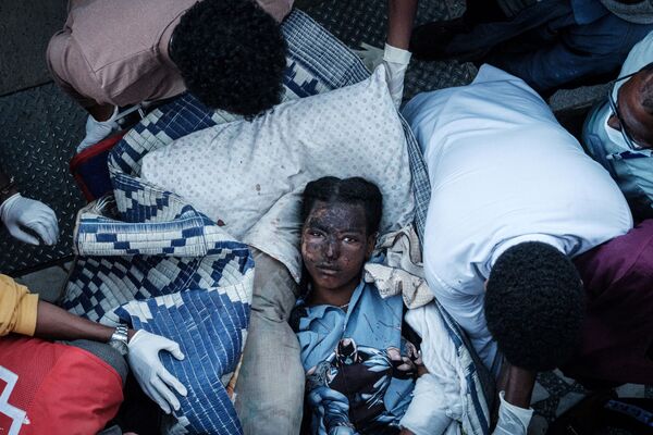 Una vecina de la localidad de Togoga de la provincia de Tigray (Etiopía) herida tras un bombardeo por el Ejército gubernamental contra un mercado local, en el cual murieron más de 50 personas. - Sputnik Mundo