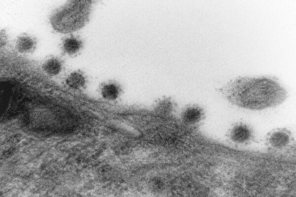 Imagen tomada con un microscopio de la cepa delta del SARS-CoV-2 - Sputnik Mundo