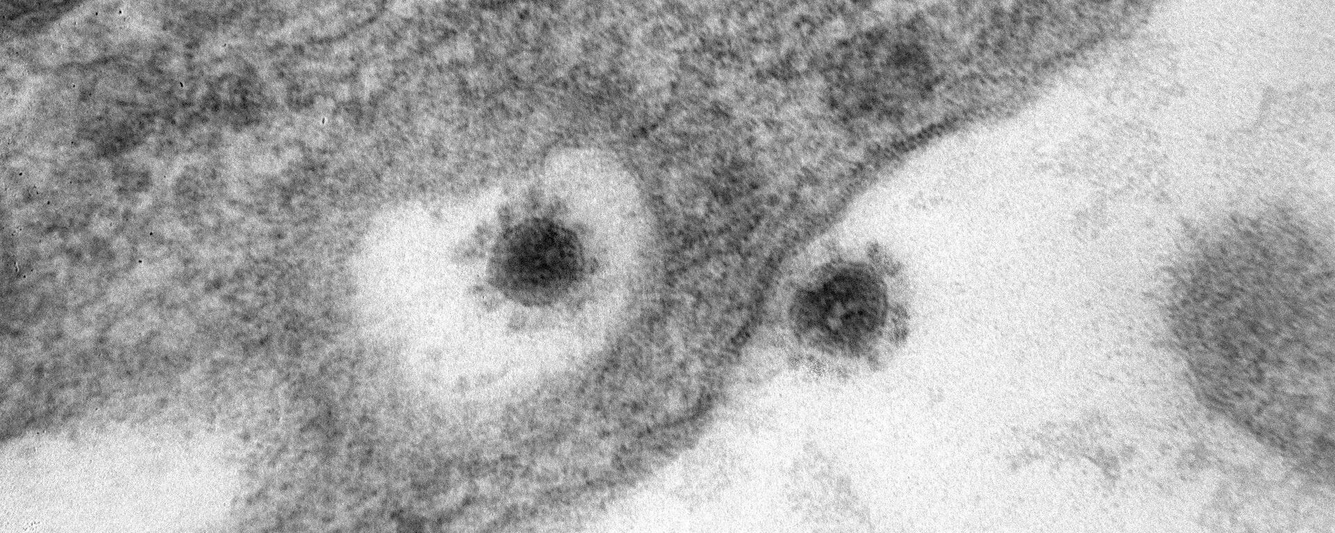 Imagen tomada con un microscopio de la cepa delta del SARS-CoV-2 - Sputnik Mundo, 1920, 25.10.2021