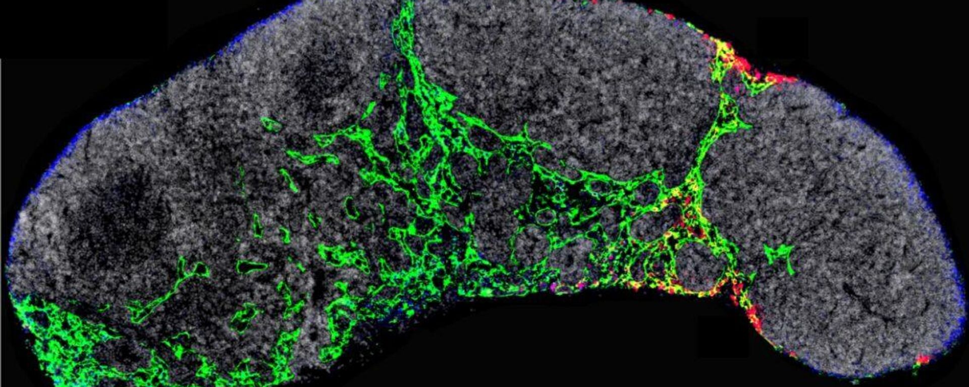 Ganglio linfático de un ratón en el que se visualizan los vasos linfáticos (verde) y los exosomas tumorales (rojo) que dirigirán las primeras etapas de la metástasis del melanoma - Sputnik Mundo, 1920, 26.11.2021