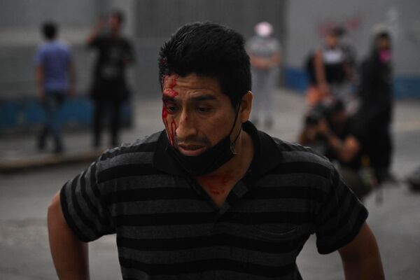 Un partidario de Pedro Castillo que resultó herido durante un enfrentamiento con la policía frente a la Prefectura de Lima, donde se encontraba detenido el depuesto expresidente. - Sputnik Mundo