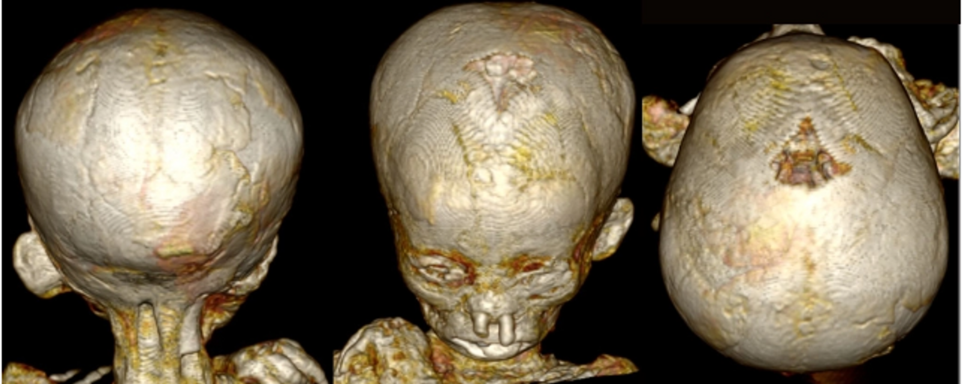 Reconstrucción 3D del cráneo de uno de los niños - Sputnik Mundo, 1920, 29.04.2023
