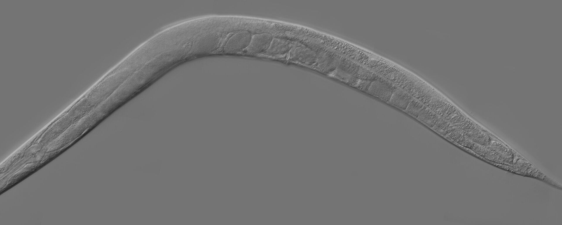 Caenorhabditis elegans - Sputnik Mundo, 1920, 25.06.2023