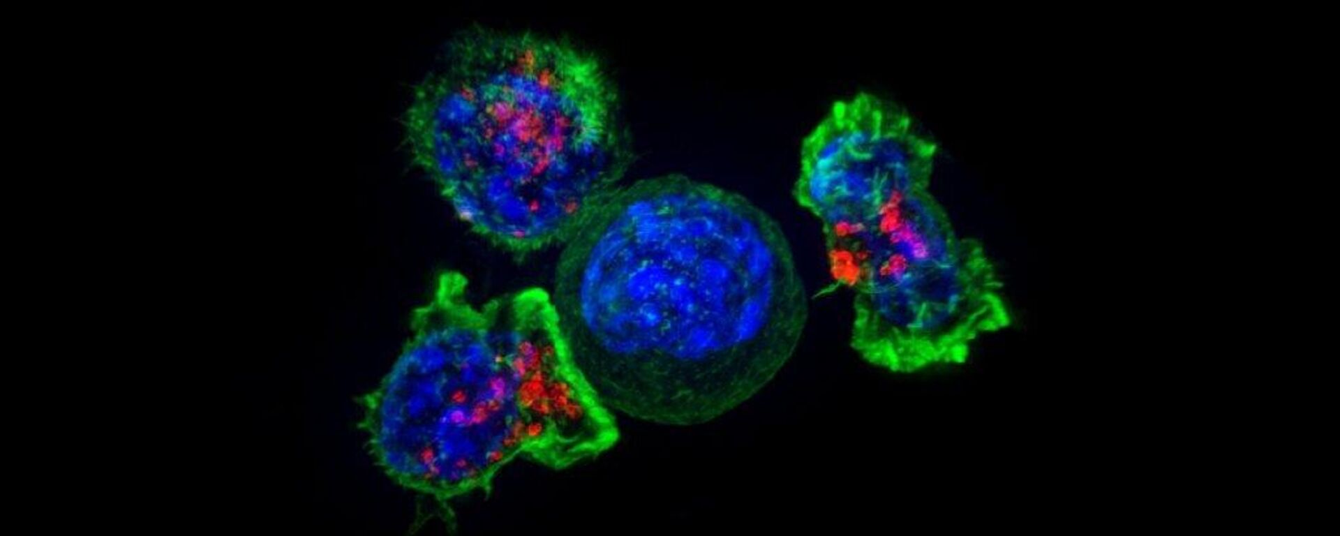 Células T (verde y rojo) rodeando una célula cancerosa (azul, centro) - Sputnik Mundo, 1920, 14.10.2023