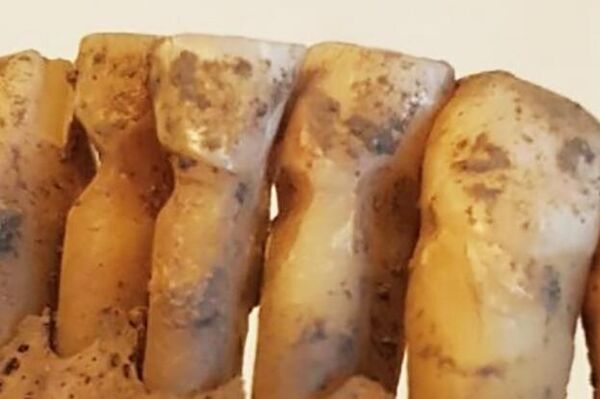 Algunos de los dientes analizados en el estudio, que muestran evidencias del uso de palillos. - Sputnik Mundo