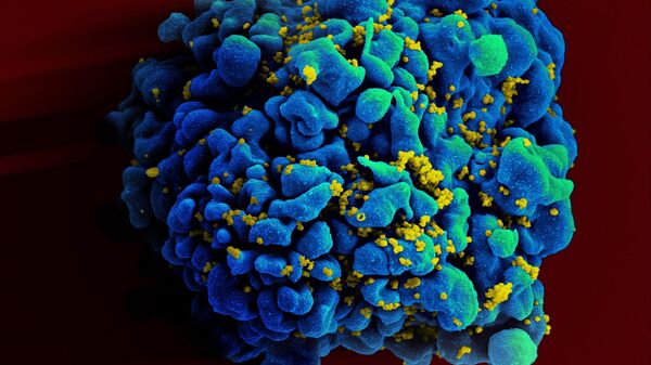Una célula T atacada por el virus del VIH - Sputnik Mundo