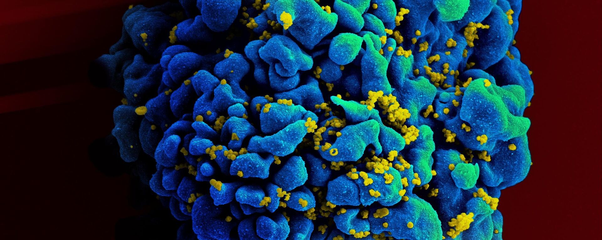 Una célula T atacada por el virus del VIH - Sputnik Mundo, 1920, 02.10.2021