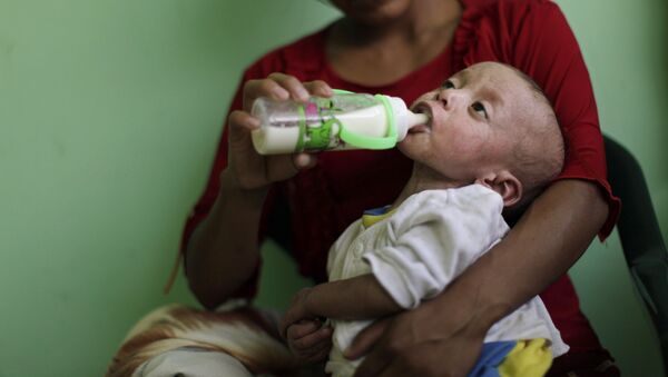 Niño guatemalteco afectado por desnutrición - Sputnik Mundo