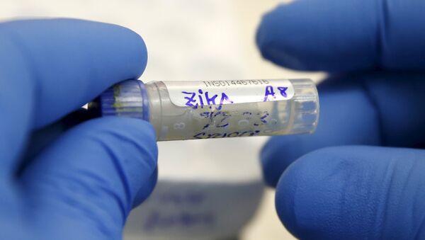 Ejemplares de sangre de un contagiado del Zika - Sputnik Mundo