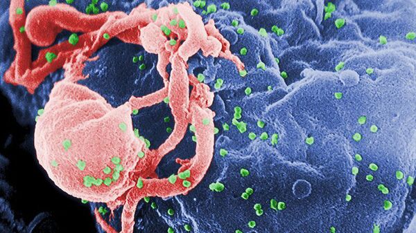Más de 18 mil personas infectadas con VIH  murieron en Rusia en 2011 - Sputnik Mundo