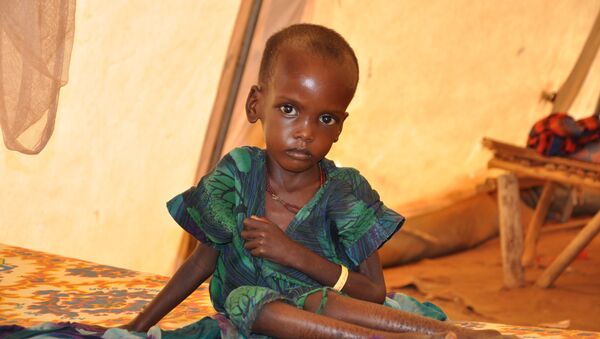 Niño desnutrido en la tienda de campaña de la ONG Médicos Sin Fronteras (MSF) - Sputnik Mundo