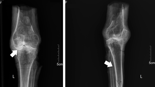 Radiografías de las rodillas de Nefertari - Sputnik Mundo