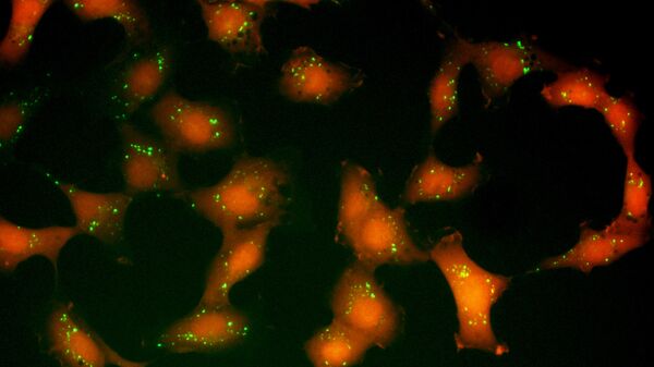 Células de cáncer (imagen referencial) - Sputnik Mundo