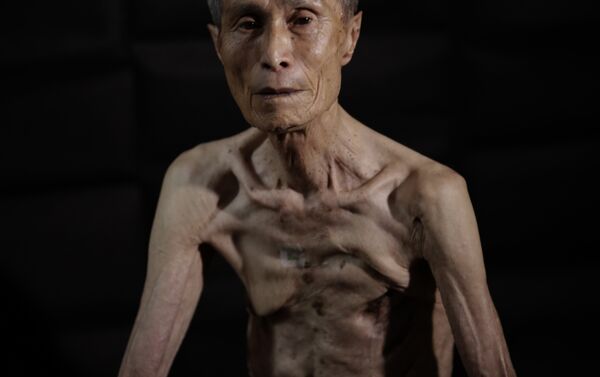 Sumiteru Taniguchi, superviviente del bombardeo atómico sobre Nagasaki ocurrido el 9 de agosto de 1945. Esta foto fue tomada el 30 de junio de 2015. - Sputnik Mundo