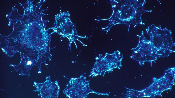 Células cancerígenas (imagen referencial) - Sputnik Mundo
