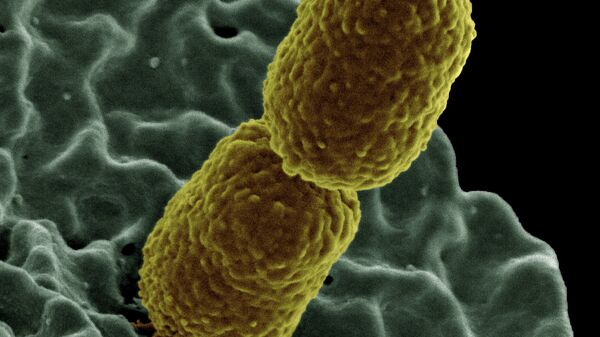 Klebsiella pneumoniae, una bacteria que provoca infecciones importantes. - Sputnik Mundo