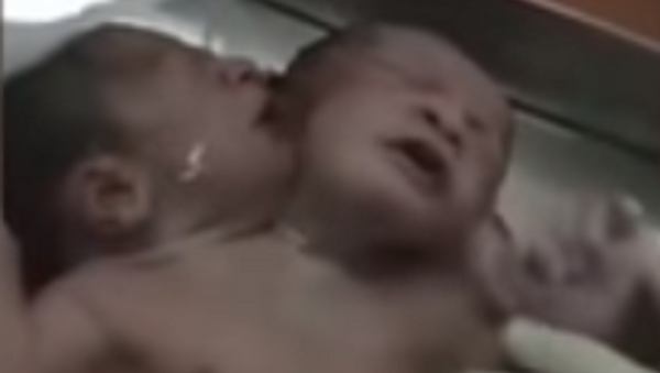 Nace en la India un bebé con dos cabezas - Sputnik Mundo