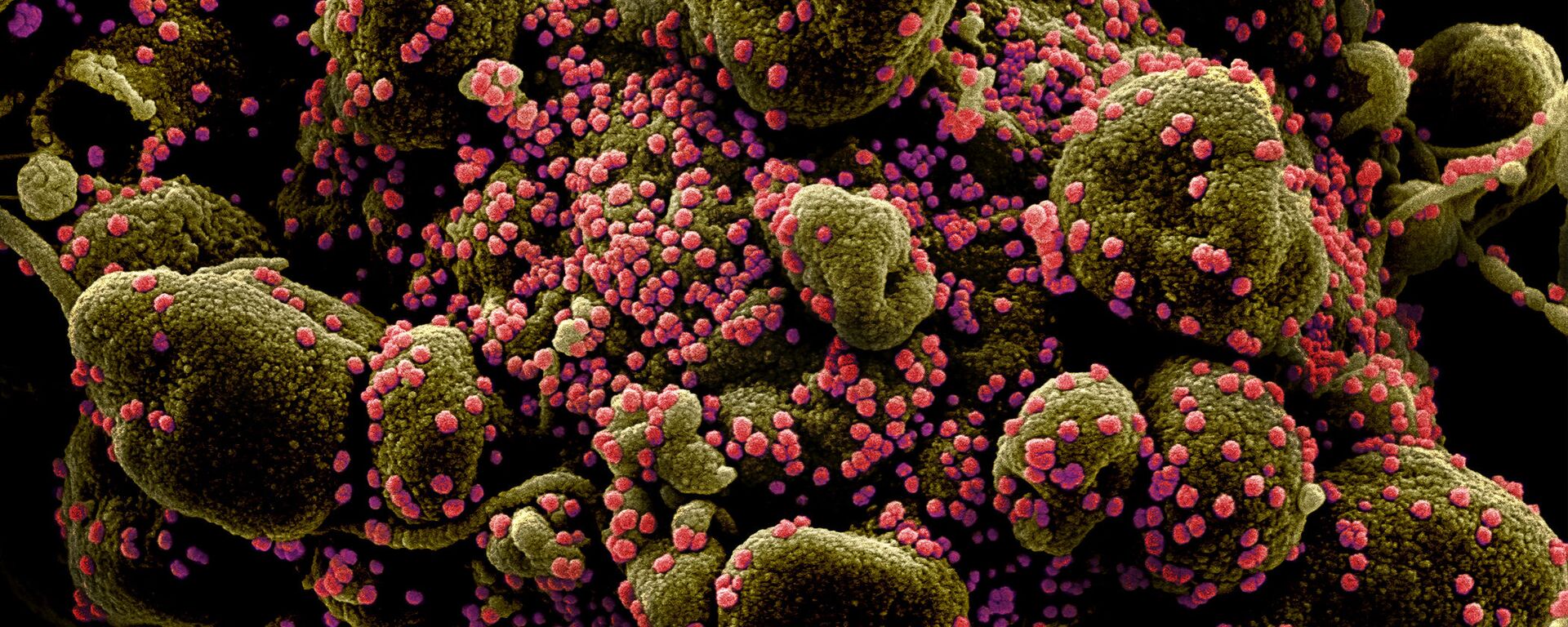 Micrografía electrónica coloreada de una célula humana (marrón verdoso) infectada por el virus SARS-COV-2 (rosa) - Sputnik Mundo, 1920, 19.05.2021