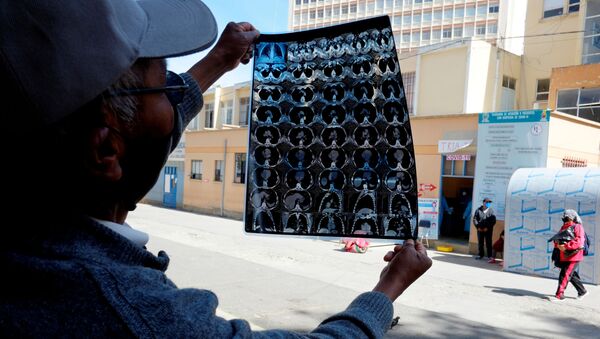 Un boliviano muestra la tomografía computarizada de los pulmones de su hijo - Sputnik Mundo