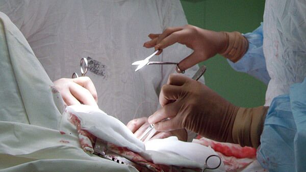 Cirujanos en Estocolmo trasplantan por primera vez en la historia órganos completamente artificiales - Sputnik Mundo