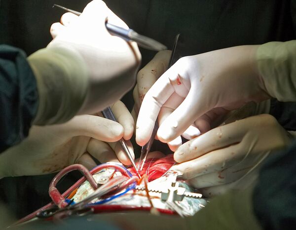 Nuevo dispositivo prolonga utilidad de corazones para trasplantes - Sputnik Mundo