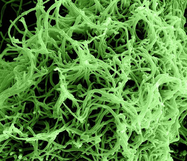 La OMS advierte de que son “inevitables” nuevos casos del ébola en Europa - Sputnik Mundo