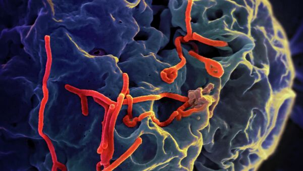 Los científicos advierten de que el ébola pueda afectar a Francia y Reino Unido en octubre - Sputnik Mundo