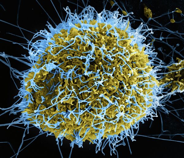 Vacuna contra el ébola fue elaborada por científicos de EEUU y Canadá en 2005 - Sputnik Mundo