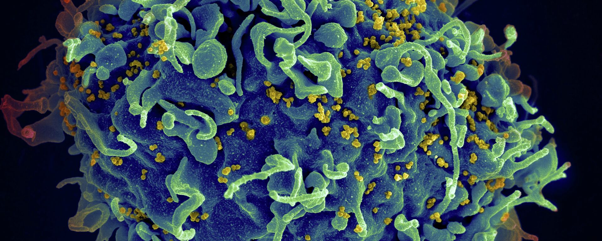 VIH, el virus del SIDA (amarillo), que está infectando una célula humana - Sputnik Mundo, 1920, 11.08.2023