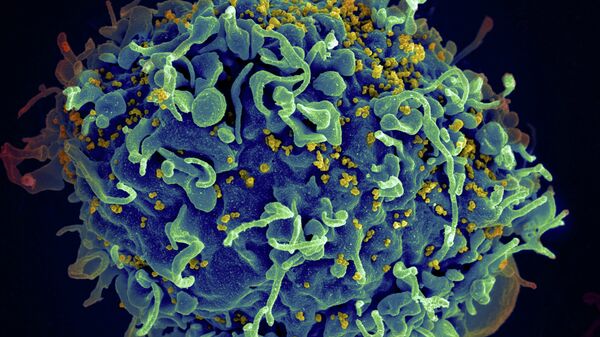 HIV, the AIDS virus (yellow), infecting a human cell - Sputnik Mundo